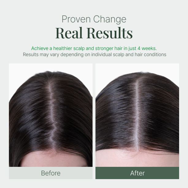 Fromforet spicule-exosome hair ampole