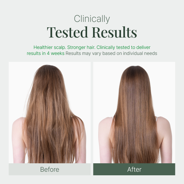 Fromforet spicule-exosome hair ampole