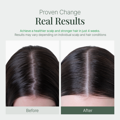 Fromforet spicule-exosome hair ampole